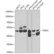Western blot analysis of various lysates using TSEN2 Antibody at 1/1000 dilution. Secondary antibody: HRP-conjugated Goat anti-Rabbit IgG (H+L) at 1/10000 dilution. Lysates/proteins: 25 µg per lane. Blocking buffer: 3% nonfat dry milk in TBST. Exposure time: 90s.