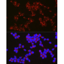 Amyloid Beta Precursor Like Protein 1 (APLP1) Antibody