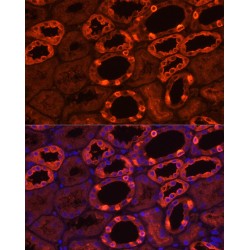 V-Type Proton ATPase Subunit B, Kidney Isoform (ATP6V1B1) Antibody