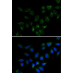 Bone Morphogenetic Protein 15 (BMP15) Antibody
