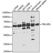 Western blot analysis of various lysates using TBL1XR1 Antibody at 1/1000 dilution. Secondary antibody: HRP-conjugated Goat anti-Rabbit IgG (H+L) at 1/10000 dilution. Lysates/proteins: 25 µg per lane. Blocking buffer: 3% nonfat dry milk in TBST. Exposure time: 10s.