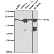 Western blot analysis of various lysates using MTHFD1L Antibody at 1/1000 dilution. Secondary antibody: HRP-conjugated Goat anti-Rabbit IgG (H+L) at 1/10000 dilution. Lysates/proteins: 25 µg per lane. Blocking buffer: 3% nonfat dry milk in TBST. Exposure time: 90s.