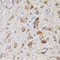 Monofunctional C1-Tetrahydrofolate Synthase, Mitochondrial (MTHFD1L) Antibody