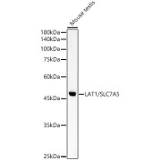 Western blot analysis of lysates from Mouse testis, using LAT1/SLC7A5 Antibody at 1/900 dilution. Secondary antibody: HRP-conjugated Goat anti-Rabbit IgG (H+L) at 1/10000 dilution. Lysates/proteins: 25 µg per lane. Blocking buffer: 3% nonfat dry milk in TBST. Exposure time: 60s.