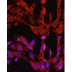 Proprotein Convertase Subtilisin/Kexin Type 9 (PCSK9) Antibody