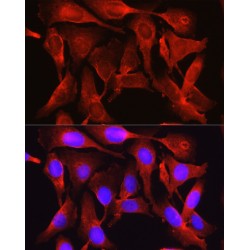 Proprotein Convertase Subtilisin/Kexin Type 9 (PCSK9) Antibody