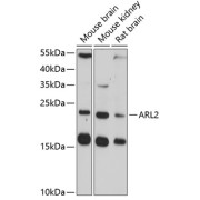 Western blot analysis of various lysates using ARL2 Antibody at 1/3000 dilution. Secondary antibody: HRP-conjugated Goat anti-Rabbit IgG (H+L) at 1/10000 dilution. Lysates/proteins: 25 µg per lane. Blocking buffer: 3% nonfat dry milk in TBST. Exposure time: 90s.