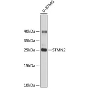 Western blot analysis of lysates from U-87MG cells, using STMN2 Antibody. Secondary antibody: HRP-conjugated Goat anti-Rabbit IgG (H+L) at 1/10000 dilution. Lysates/proteins: 25 µg per lane. Blocking buffer: 3% nonfat dry milk in TBST.