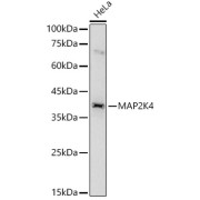 Immunoprecipitation analysis of 200 µg extracts of MCF-7 cells, using 3 µg MAP2K4 antibody. Western blot was performed from the immunoprecipitate using MAP2K4 antibody at a dilution of 1/1000.