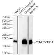Western blot analysis of various lysates, using VSNL1/VILIP-1 Antibody at 1/400 dilution. Secondary antibody: HRP-conjugated Goat anti-Rabbit IgG (H+L) at 1/10000 dilution. Lysates/proteins: 25 µg per lane. Blocking buffer: 3% nonfat dry milk in TBST. Exposure time: 30s.