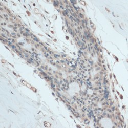 Glyceraldehyde-3-Phosphate Dehydrogenase, Spermatogenic (GAPDHS) Antibody