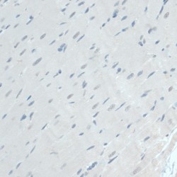 Glyceraldehyde-3-Phosphate Dehydrogenase, Spermatogenic (GAPDHS) Antibody