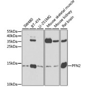 Western blot analysis of various lysates using PFN2 Antibody at 1/500 dilution. Secondary antibody: HRP-conjugated Goat anti-Rabbit IgG (H+L) at 1/10000 dilution. Lysates/proteins: 25 µg per lane. Blocking buffer: 3% nonfat dry milk in TBST. Exposure time: 90s.