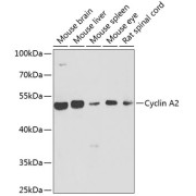 Western blot analysis of various lysates using Cyclin A2 Antibody at 1/1000 dilution. Secondary antibody: HRP-conjugated Goat anti-Rabbit IgG (H+L) at 1/10000 dilution. Lysates/proteins: 25 µg per lane. Blocking buffer: 3% nonfat dry milk in TBST. Exposure time: 90s.