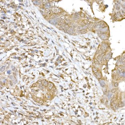 Suppressor of Cytokine Signaling 1 (SOCS1) Antibody