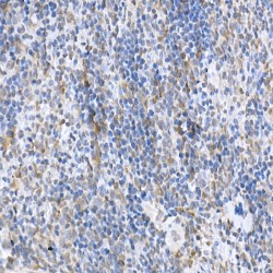 Suppressor of Cytokine Signaling 1 (SOCS1) Antibody