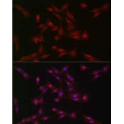 Suppressor of Cytokine Signaling 1 (SOCS1) Antibody