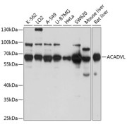 Western blot analysis of various lysates using ACADVL Antibody at 1/1000 dilution. Secondary antibody: HRP-conjugated Goat anti-Rabbit IgG (H+L) at 1/10000 dilution. Lysates/proteins: 25 µg per lane. Blocking buffer: 3% nonfat dry milk in TBST. Exposure time: 5s.
