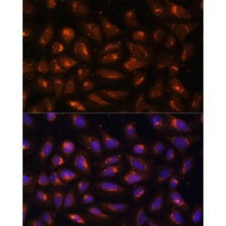 Creatine Kinase, Mitochondrial 1B (CKMT1B) Antibody