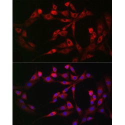 Piezo-Type Mechanosensitive Ion Channel Component 1 (PIEZO1) Antibody