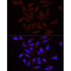 Piezo-Type Mechanosensitive Ion Channel Component 1 (PIEZO1) Antibody