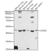 abx123101