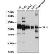 Western blot analysis of various lysates using CTPS1 Antibody at 1/3000 dilution. Secondary antibody: HRP-conjugated Goat anti-Rabbit IgG (H+L) at 1/10000 dilution. Lysates/proteins: 25 µg per lane. Blocking buffer: 3% nonfat dry milk in TBST. Exposure time: 5s.