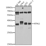 Western blot analysis of various lysates using NTHL1 Antibody at 1/1000 dilution. Secondary antibody: HRP-conjugated Goat anti-Rabbit IgG (H+L) at 1/10000 dilution. Lysates/proteins: 25 µg per lane. Blocking buffer: 3% nonfat dry milk in TBST. Exposure time: 5s.