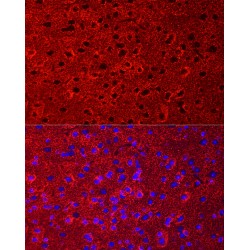 Excitatory Amino Acid Transporter 2 / EAAT2 (SLC1A2) Antibody