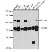 Western blot analysis of various lysates using mlXIPL Antibody at 1/1000 dilution. Secondary antibody: HRP-conjugated Goat anti-Rabbit IgG (H+L) at 1/10000 dilution. Lysates/proteins: 25 µg per lane. Blocking buffer: 3% nonfat dry milk in TBST. Exposure time: 10s.