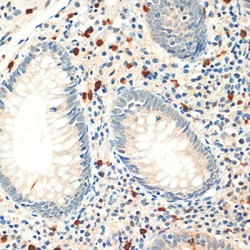 Forkhead Box Protein P3 (FOXP3) Antibody