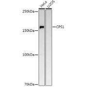 Western blot analysis of various lysates using CPS1 Antibody at 1/500 dilution. Secondary antibody: HRP-conjugated Goat anti-Rabbit IgG (H+L) at 1/10000 dilution. Lysates/proteins: 25 µg per lane. Blocking buffer: 3% nonfat dry milk in TBST. Exposure time: 10s.