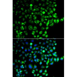 RAB31, Member RAS Oncogene Family (RAB31) Antibody