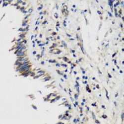 SET And MYND Domain-Containing Protein 1 (SMYD1) Antibody