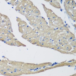 SET And MYND Domain-Containing Protein 1 (SMYD1) Antibody