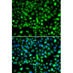 SET And MYND Domain-Containing Protein 1 (SMYD1) Antibody