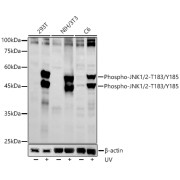 Western blot analysis of various lysates, using Phospho-JNK1/2-T183/Y185 Antibody at 1/5000 dilution. 293T, NIH/3T3 and C6 cells were treated by UV at room temperature for 15-30 minutes. Secondary antibody: HRP-conjugated Goat anti-Rabbit IgG (H+L) at 1/10000 dilution. Lysates/proteins: 25 µg per lane. Blocking buffer: 3% nonfat dry milk in TBST. Exposure time: 180s.
