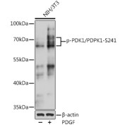 Western blot analysis of lysates from NIH/3T3 cells, using Phospho-PDK1/PDPK1-S241 antibody at 1/1000 dilution. NIH/3T3 cells were treated by PDGF (100 ng/ml) at 37 °C for 30 minutes after serum-starvation overnight. Secondary antibody: HRP-conjugated Goat anti-Rabbit IgG (H+L) at 1/10000 dilution. Lysates/proteins: 25 µg per lane. Blocking buffer: 3% BSA. Exposure time: 60s.