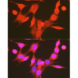 PDK1 (pS241) Antibody