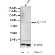Western blot analysis of lysates from A-431 cells, using Phospho-Fyn-S21 Antibody at 1/1000 dilution. A-431 cells were treated by 10% FBS after serum-starvation overnight. Secondary antibody: HRP-conjugated Goat anti-Rabbit IgG (H+L) at 1/10000 dilution. Lysates/proteins: 25 µg per lane. Blocking buffer: 3% BSA.