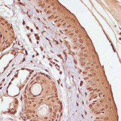 CTNNB1 (pS33 / 37 / T41) Antibody