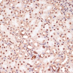 CTNNB1 (pS33 / 37 / T41) Antibody