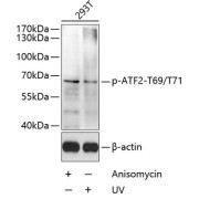 Western blot analysis of lysates from 293T cells, using Phospho-ATF2-T69/T71 Antibody at 1/1000 dilution. Secondary antibody: HRP-conjugated Goat anti-Rabbit IgG (H+L) at 1/10000 dilution. Lysates/proteins: 25 µg per lane. Blocking buffer: 3% BSA.