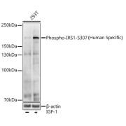 abx123315