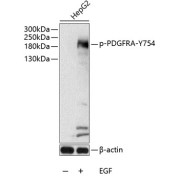 Western blot analysis of lysates from HepG2 cells, using Phospho-PDGFR alpha-Y754 Antibody at 1/1000 dilution. HepG2 cells were treated by EGF (100ng/ml) for 30 minutes after serum-starvation overnight. Secondary antibody: HRP-conjugated Goat anti-Rabbit IgG (H+L) at 1/10000 dilution. Lysates/proteins: 25 µg per lane. Blocking buffer: 3% BSA.