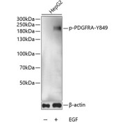 abx123318