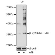 Western blot analysis of various lysates using Phospho-Cyclin D1-T286 antibody at 1/1000 dilution. C6 cells were treated by ATP(5 mM) at 30 °C for 1 hour. Secondary antibody: HRP-conjugated Goat anti-Rabbit IgG (H+L) at 1/10000 dilution. Lysates/proteins: 25 µg per lane. Blocking buffer: 3% nonfat dry milk in TBST. Exposure time: 60s.