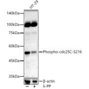 Western blot analysis of lysates from HT-29 cells, using Phospho-cdc25C-S216 Antibody at 1/400 dilution. HT-29 cells were treated by λ-PP mixed solution (1ul) at 30 °C for 30 minutes. Secondary antibody: HRP-conjugated Goat anti-Rabbit IgG (H+L) at 1/10000 dilution. Lysates/proteins: 25 µg per lane. Blocking buffer: 3% nonfat dry milk in TBST. Exposure time: 90s.