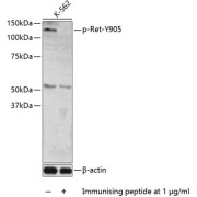 Western blot analysis of lysates from K562 cells, using Phospho-Ret-Y905 Antibody. Secondary antibody: HRP-conjugated Goat anti-Rabbit IgG (H+L) at 1/10000 dilution. Lysates/proteins: 25 µg per lane. Blocking buffer: 3% BSA.