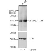 Western blot analysis of lysates from A-431 cells, using Phospho-STK11-T189 Antibody. A-431 cells were treated by 10% FBS for after serum-starvation overnight. Secondary antibody: HRP-conjugated Goat anti-Rabbit IgG (H+L) at 1/10000 dilution. Lysates/proteins: 25 µg per lane. Blocking buffer: 3% BSA.